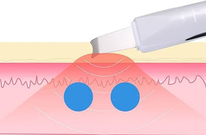 Professional 3-in-1 Facial Blackhead Remover and Pore Cleanse Tool